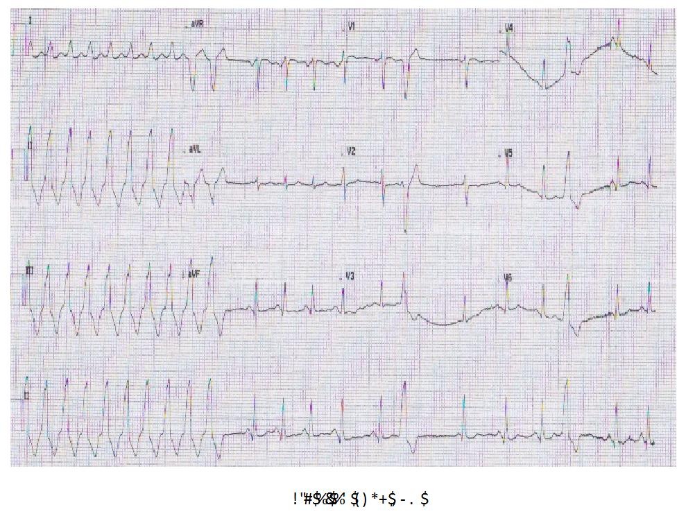 Rvot Vt